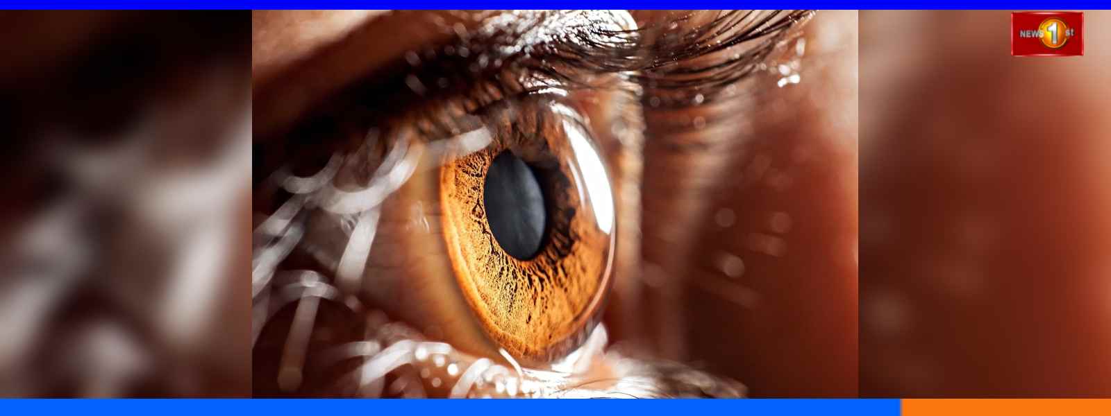 ලෝක දෘෂ්ටි දිනය අදයි...